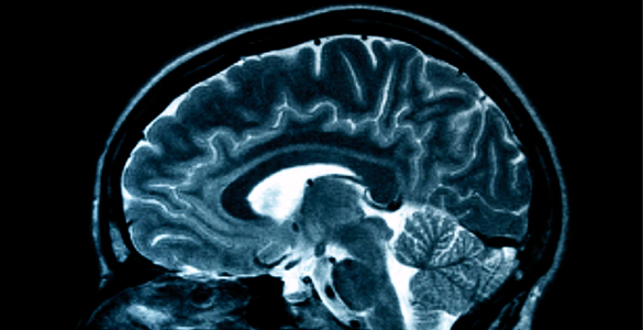 brain